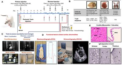 Requirements for a Robust Animal Model to Investigate the Disease Mechanism of Autoimmune Complications Associated With ARF/RHD